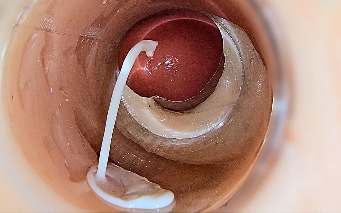 Camera Inside Deep Pussy Captures Huge Ejaculation of Sperm